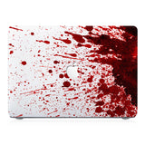 This lightweight, slim hardshell with 8 design is easy to install and fits closely to protect against scratches